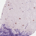 Immunohistochemical staining of human cerebellum shows moderate nuclear positivity in the molecular layer.
