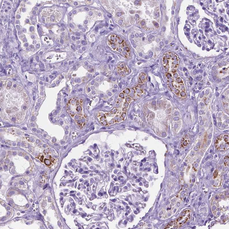 Anti-TMEM132E Antibody