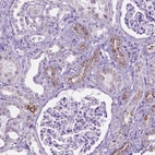 Anti-TMEM132E Antibody