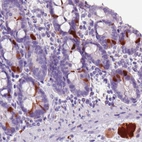 Immunohistochemical staining of human duodenum shows strong immunoreactivity in the neuroendocrine cells, as well as in the local ganglionic cells.