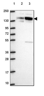 Lane 1: Marker [kDa] 250, 130, 95, 72, 55, 36, 28, 17, 10_br/_Lane 2: Human cell line RT-4_br/_Lane 3: Human cell line U-251 MG