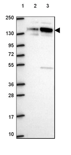 Lane 1: Marker [kDa] 250, 130, 95, 72, 55, 36, 28, 17, 10_br/_Lane 2: Human cell line RT-4_br/_Lane 3: Human cell line U-251 MG