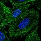 Immunofluorescent staining of human cell line SiHa shows localization to actin filaments.
