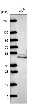 Anti-QTRT2 Antibody