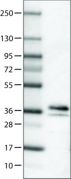 Lane 1: Marker [kDa]_br/_Lane 2: Human brain tissue lysate
