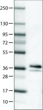 Anti-SCGN Antibody