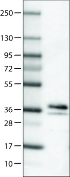 Lane 1: Marker [kDa]_br/_Lane 2: Human brain tissue lysate
