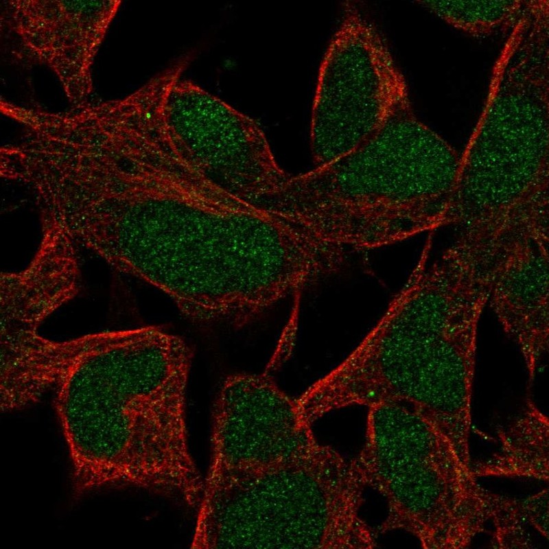 Anti-INO80B Antibody