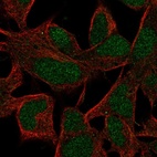 Anti-INO80B Antibody