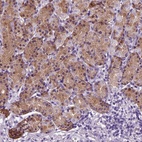 Anti-HMCN2 Antibody