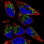 Anti-TMEM71 Antibody