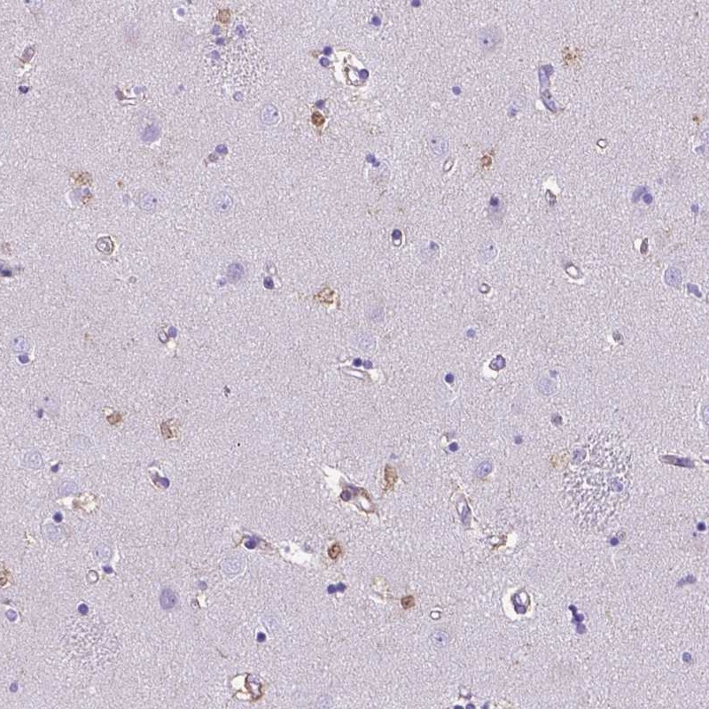 Anti-TMEM169 Antibody