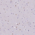 Anti-TMEM169 Antibody