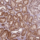 Anti-MORN1 Antibody