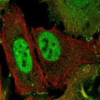 Immunofluorescent staining of human cell line U-2 OS shows localization to nucleoplasm, plasma membrane & cell junctions.