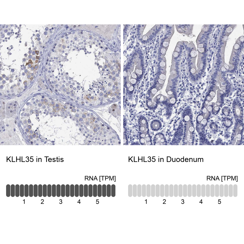 Anti-KLHL35 Antibody