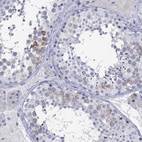 Immunohistochemical staining of human testis shows high expression.