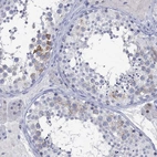 Immunohistochemical staining of human testis shows high expression.