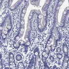Immunohistochemical staining of human duodenum shows low expression as expected.