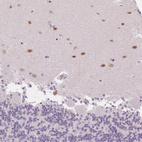 Anti-SCGN Antibody