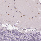 Immunohistochemical staining of human cerebellum shows moderate positivity in cells in molecular layer.