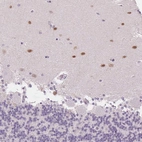 Immunohistochemical staining of human cerebellum shows moderate positivity in cells in molecular layer.