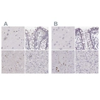 Anti-RUNDC3A Antibody
