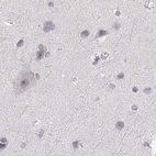 Immunohistochemical staining of human cerebral cortex using Anti-RUNDC3A antibody HPA070733.