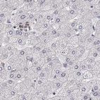 Immunohistochemical staining of human liver using Anti-RUNDC3A antibody HPA070733.