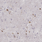 Immunohistochemical staining of human hippocampus using Anti-RUNDC3A antibody HPA070733.