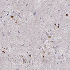 Immunohistochemical staining of human hippocampus using Anti-RUNDC3A antibody HPA070733.