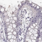 Immunohistochemical staining of human colon using Anti-RUNDC3A antibody HPA070733.