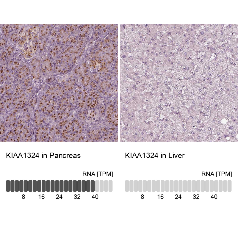 Anti-KIAA1324 Antibody