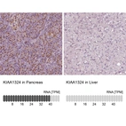 Anti-KIAA1324 Antibody