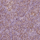 Immunohistochemical staining of human pancreas shows strong cytoplasm granular positivity in exocrine glandular cells.