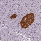 Immunohistochemical staining of human pancreas shows strong cytoplasmic and nuclear positivity in islets of Langerhans.