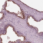 Immunohistochemical staining of human prostate shows strong cytoplasm granular positivity in glandular cells.