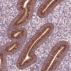 Anti-KIAA1324 Antibody