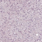 Immunohistochemical staining of human liver shows no positivity as expected.