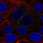 Immunofluorescent staining of human cell line MCF7 shows localization to plasma membrane.