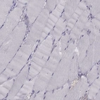 Immunohistochemical staining of human skeletal muscle shows no positivity in myocytes as expected.