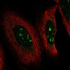 Immunofluorescent staining of human cell line U-2 OS shows localization to nucleoli.