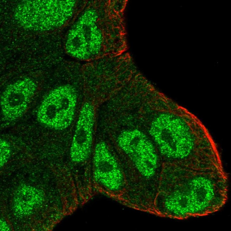 Anti-ATXN1 Antibody