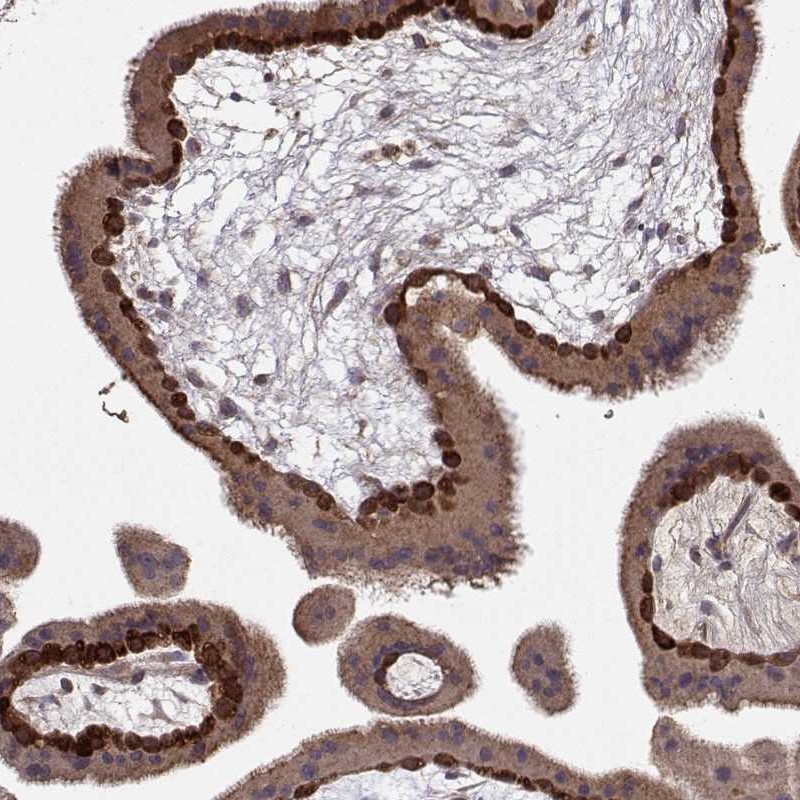 Anti-WNT6 Antibody