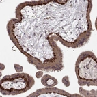 Anti-WNT6 Antibody