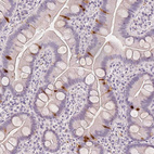Immunohistochemical staining of human small intestine shows moderate to strong positivity in enteroendocrine cells.