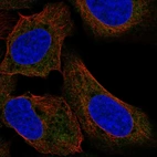 Anti-TTF2 Antibody