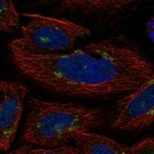 Anti-GLT8D2 Antibody