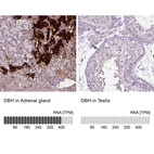 Anti-DBH Antibody