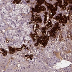 Immunohistochemical staining of human adrenal gland shows strong cytoplasmic positivity in glandular cells.